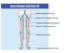 Склеротерапия. Вены нижних конечностей