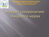 Неврит (невропатия) лицевого нерва