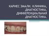 Кариес эмали. Клиника, диагностика, дифференциальная диагностика