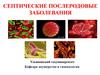 Септические послеродовые заболевания