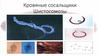 Кровяные сосальщики. Шистосомозы