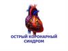 Острый коронарный синдром