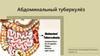 Абдоминальный туберкулёз