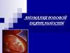 Аномалия родовой деятельности