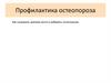 Профилактика остеопороза Как сохранить крепкие кости и избежать остеопороза