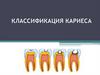Классификация кариеса