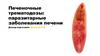 Печеночные трематодозы: паразитарные заболевания печени