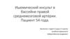 Ишемический инсульт в бассейне правой среднемозговой артерии. Пациент 54 года